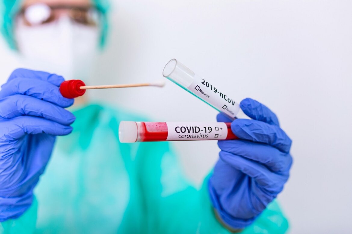 Tamponi anti Covid-19 Infermiere con test anti Covid in mano
